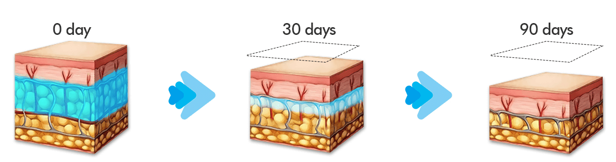 Máy Giảm Béo Quang Đông 360 CRYOLIPOLYSIS | Cao Cấp Bắc Kinh 5 MÁY GIẢM BÉO QUANG ĐÔNG 360 Cryolipolysis SANHE - 07