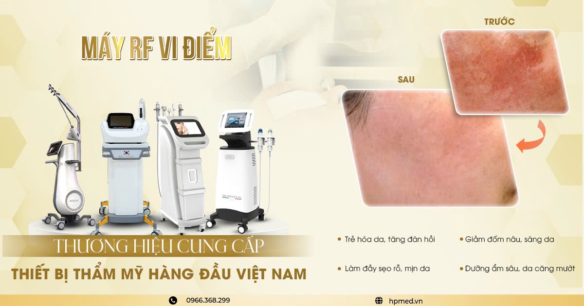 Máy RF Vi Điểm